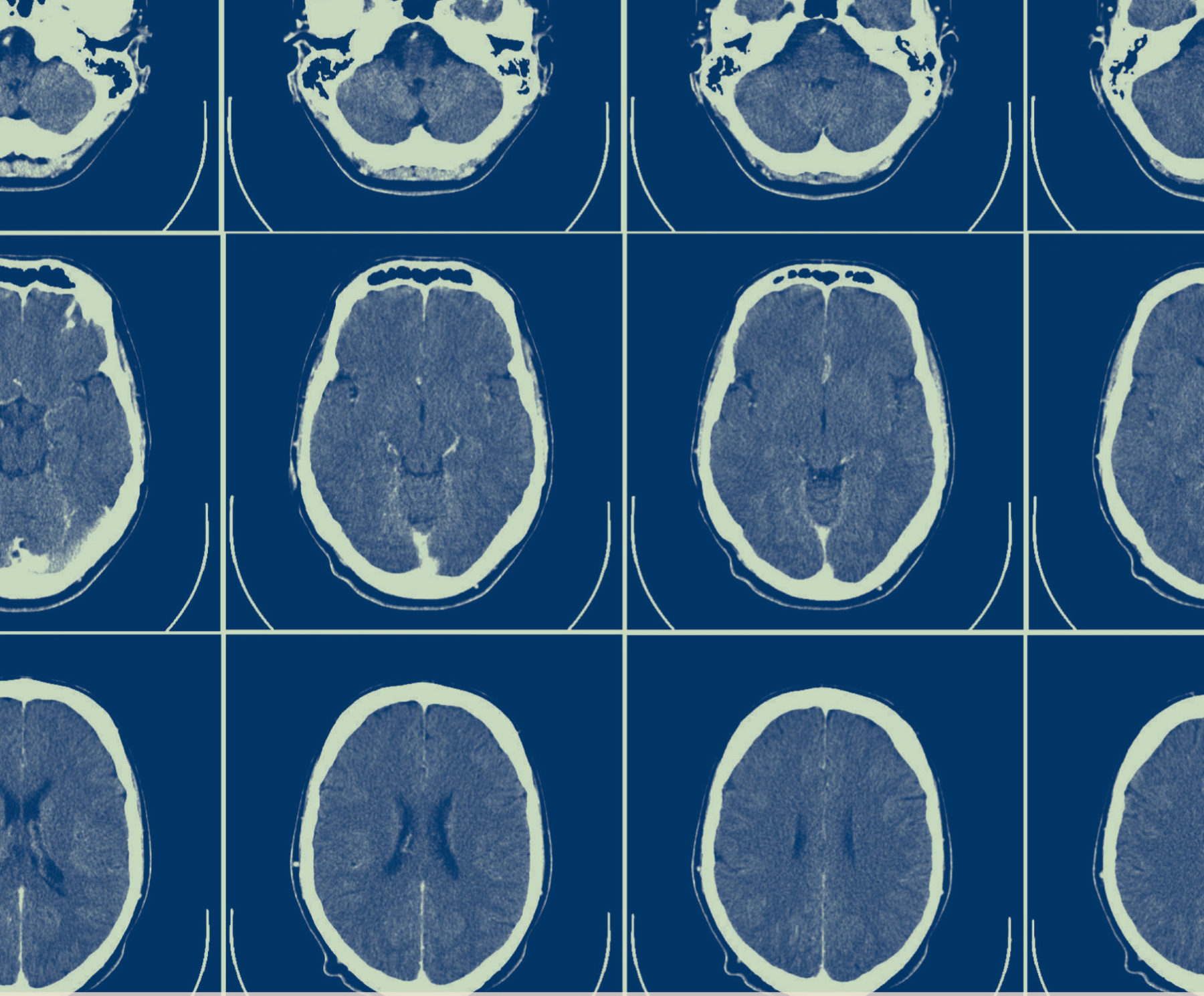 Vergunning verplicht voor total bodyscan