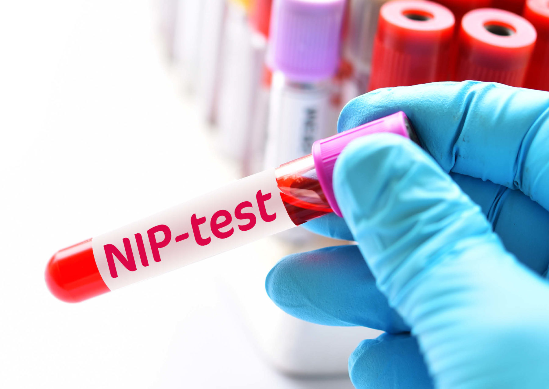 Resultaten NIPT- onderzoek bekend