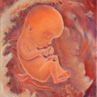 Afbeelding voor keuze nummer 2