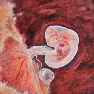 Afbeelding voor keuze nummer 1