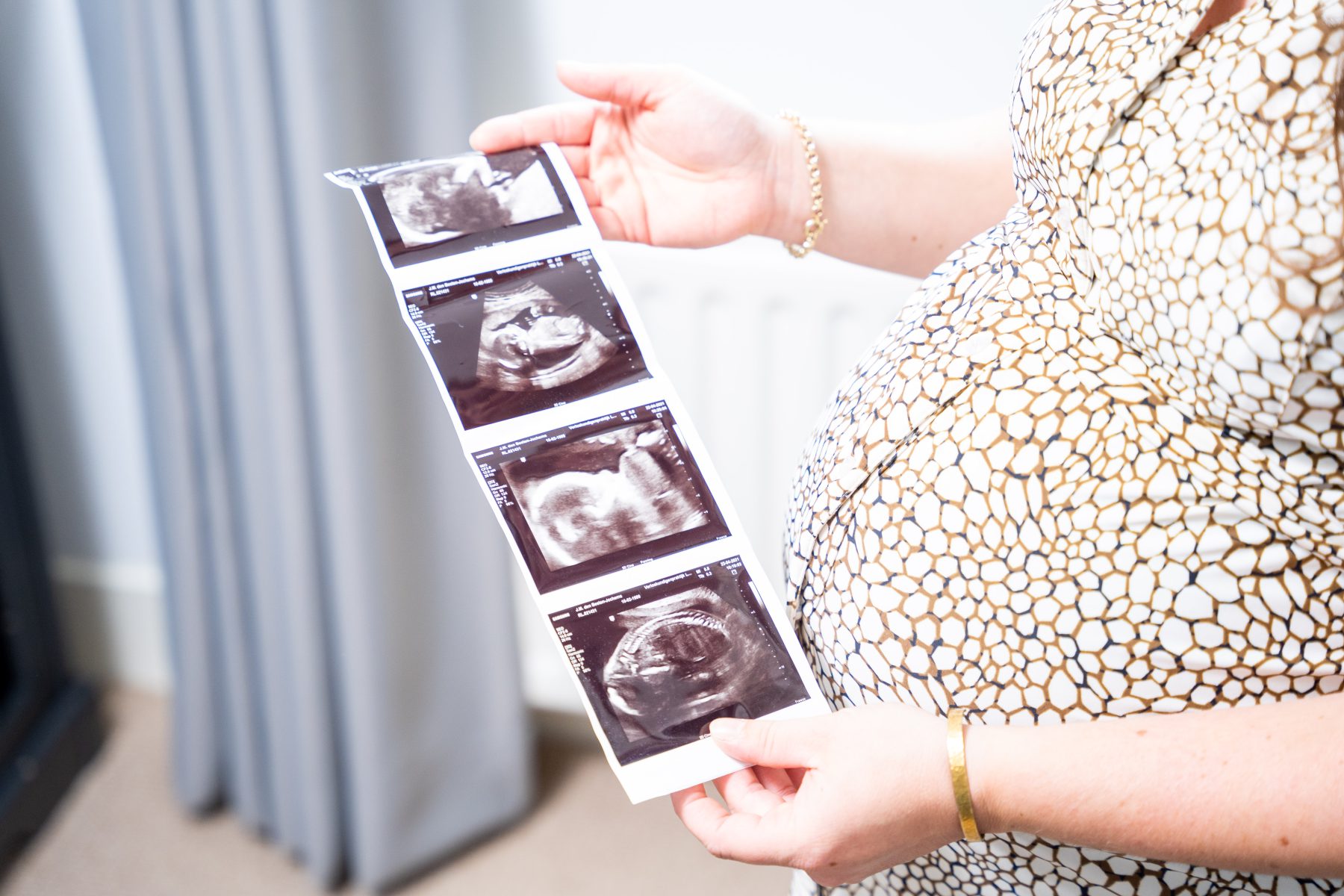 De (on)zekerheid van prenataal onderzoek