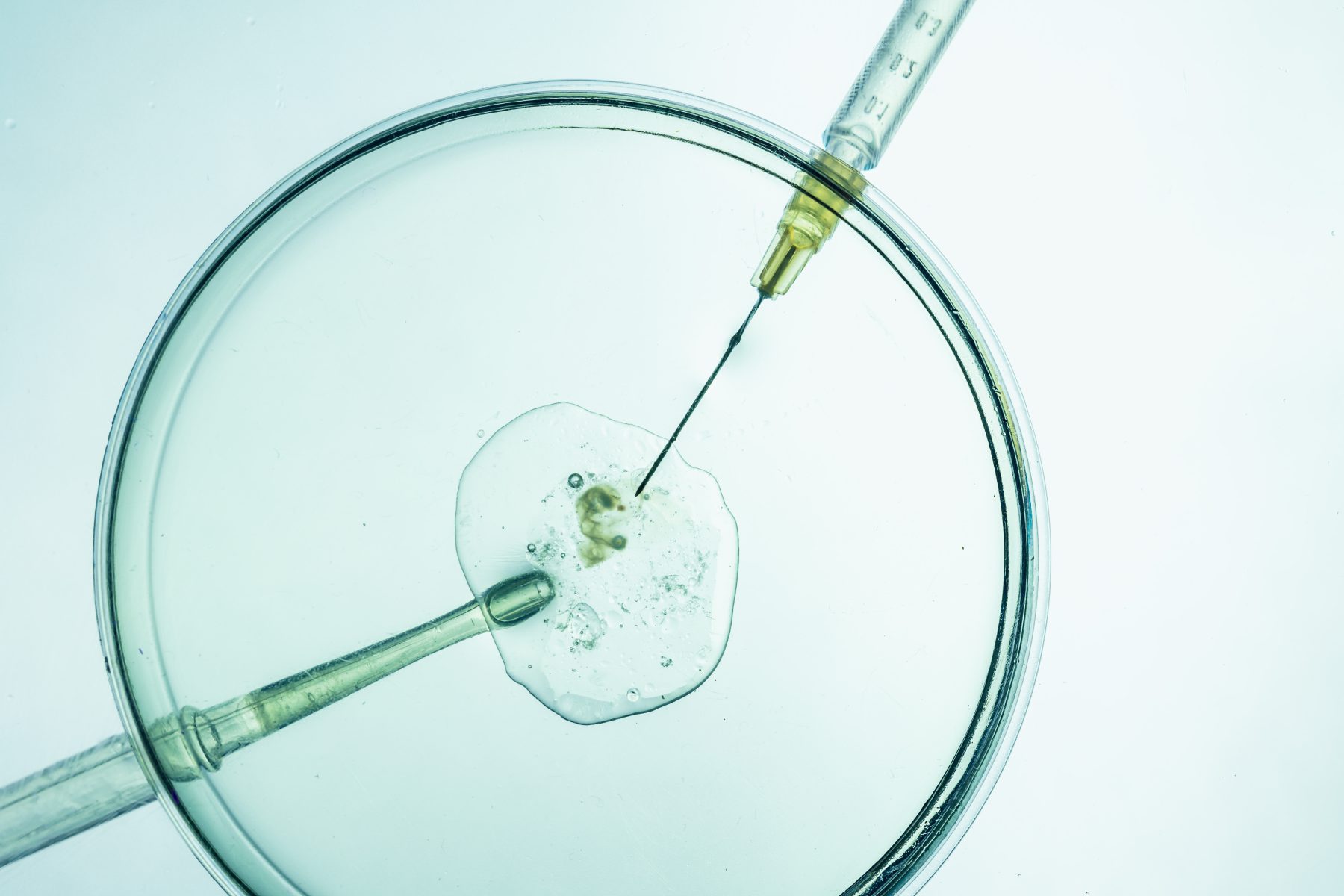 Oproep om tegen de wijziging van de Embryowet te stemmen